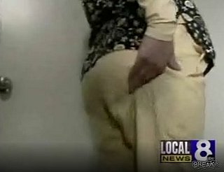 Woman Unsatisfied With Her Butt Implants